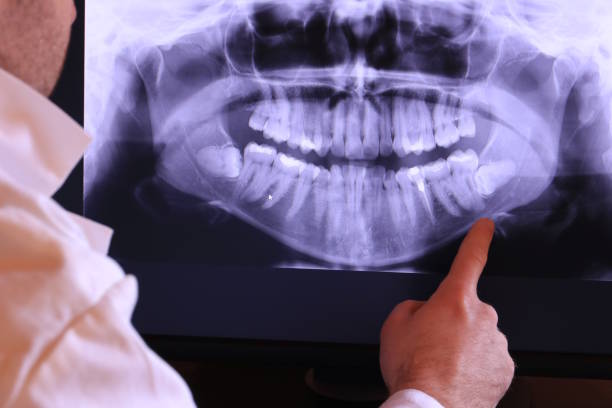 Best Emergency Dental Care for Broken or Chipped Teeth in Hondo, TX
