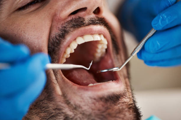 Best Emergency Treatment for Dental Infections or Abscesses in Hondo, TX